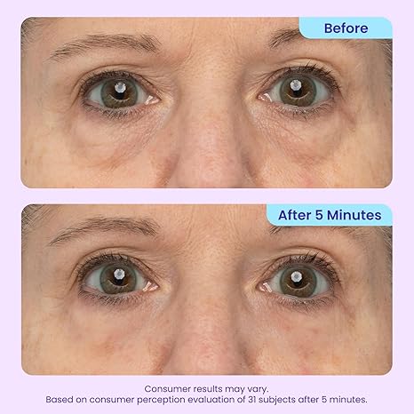 Instant Lift Eye Gel for Puffiness, Bags & Dark Circles